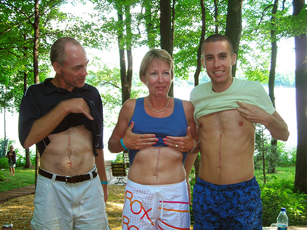 Johanna’s uncle Ken, aunt Karen, and brother,  Brian show off their surgical scars